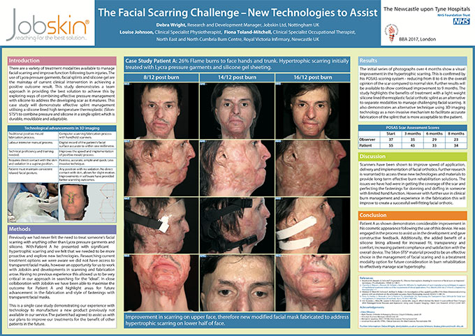 Facial-scarring-challenge