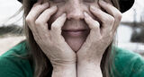 The Psychological Effects of Burn Scars