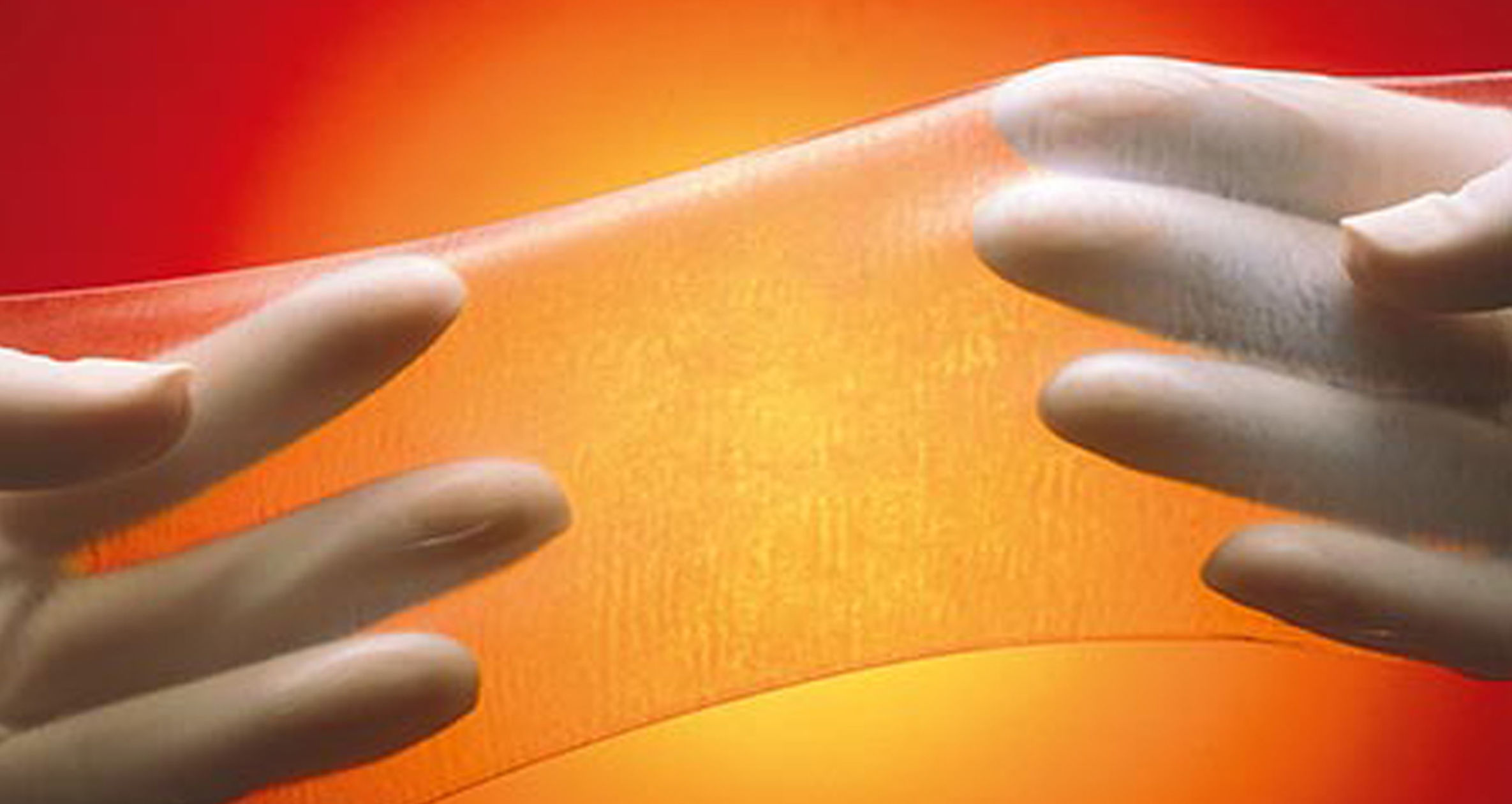 Research into New BurnCare Technology