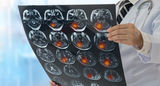 Another Successful Stroke Awareness Month Draws to a Close