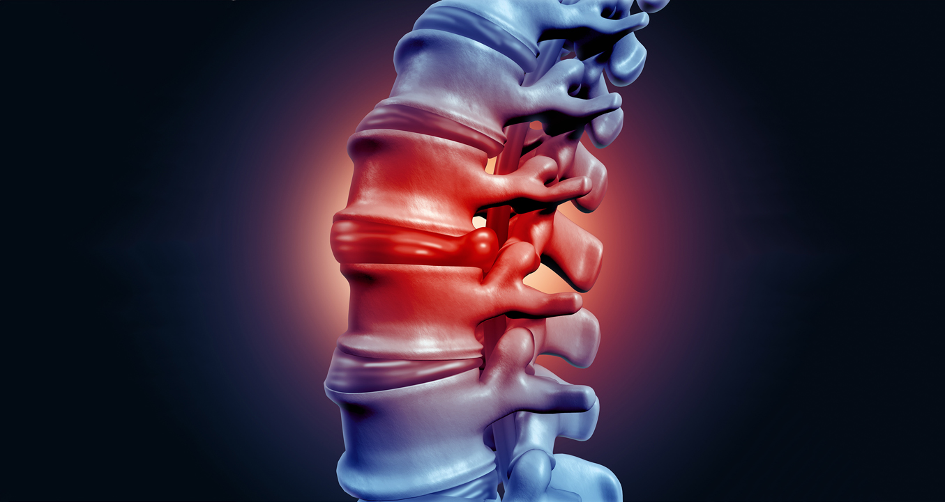 The Facts about Acquired Spinal Injury