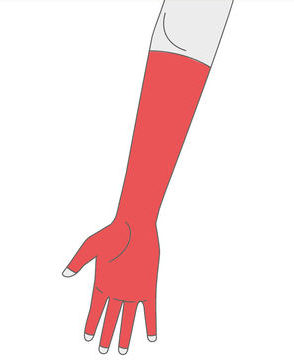 Hand & Arm