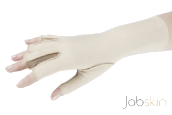 Oedema Gloves: A Helping Hand